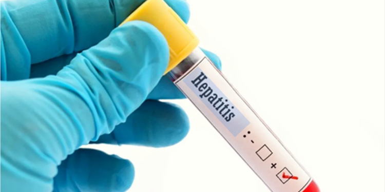 Guanajuato está alerta sobre la hepatitis infantil