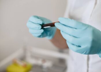 Registran segundo caso de viruela símica en Guanajuato