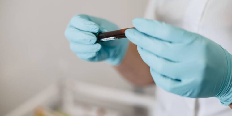 Registran segundo caso de viruela símica en Guanajuato