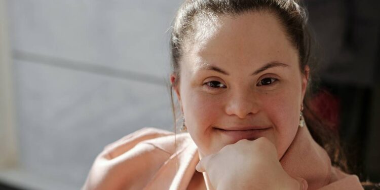 Alistan 2da. Jornada ACD Down para atención de personas con síndrome de Down