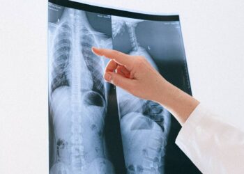 ¿Cuáles son los principales síntomas del cáncer de pulmón? Recuerda que la detección temprana salva vidas