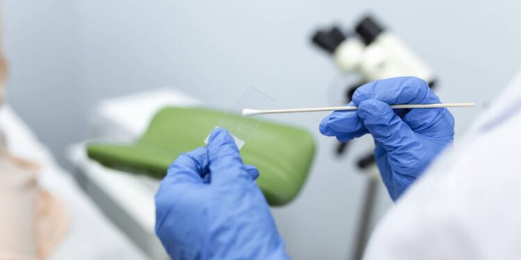¿Por qué es importante hacerse el Papanicolau?