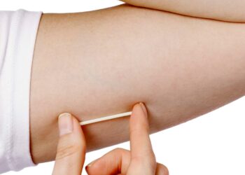 ¿Buscas un método anticonceptivo? En Valle de Santiago aplicarán gratuitamente implantes subdérmicos a mujeres