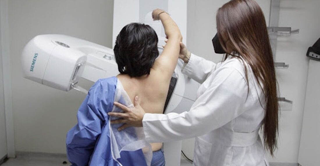 ¡Cuídate! El Sistema de Salud de Guanajuato ofrece pruebas de mastografía gratuitas