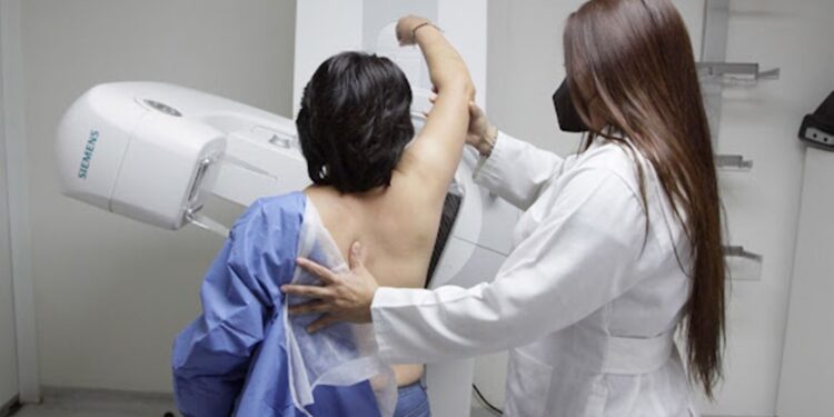 ¡Cuídate! El Sistema de Salud de Guanajuato ofrece pruebas de mastografía gratuitas