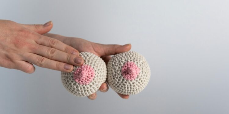 ¡La detección oportuna puede salvarte la vida! ¿Cuál es la forma correcta de revisar las mamas?