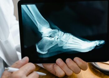 ¿Necesitas radiografías? DIF León brinda el servicio a bajo costo