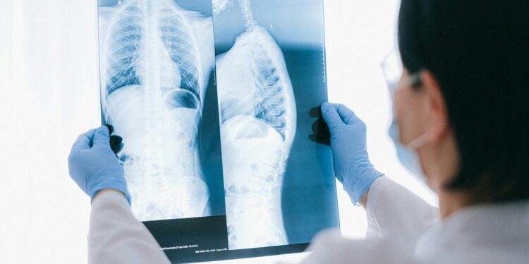 Reforman ley en Guanajuato para otorgar pensión a personas con discapacidad permanente