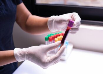 Guanajuato mantiene vigilancia epidemiológica por hantavirus; estos son los síntomas y así se contagia