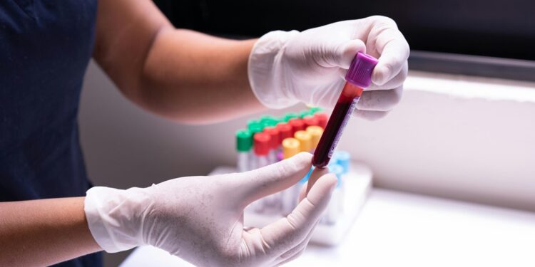 Guanajuato mantiene vigilancia epidemiológica por hantavirus; estos son los síntomas y así se contagia