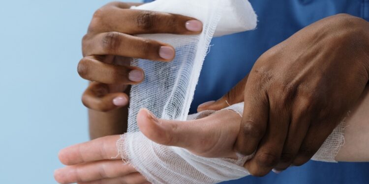 ¿Cuáles son las recomendaciones ante los casos humanos de miasis por gusano barrenador en Guanajuato?